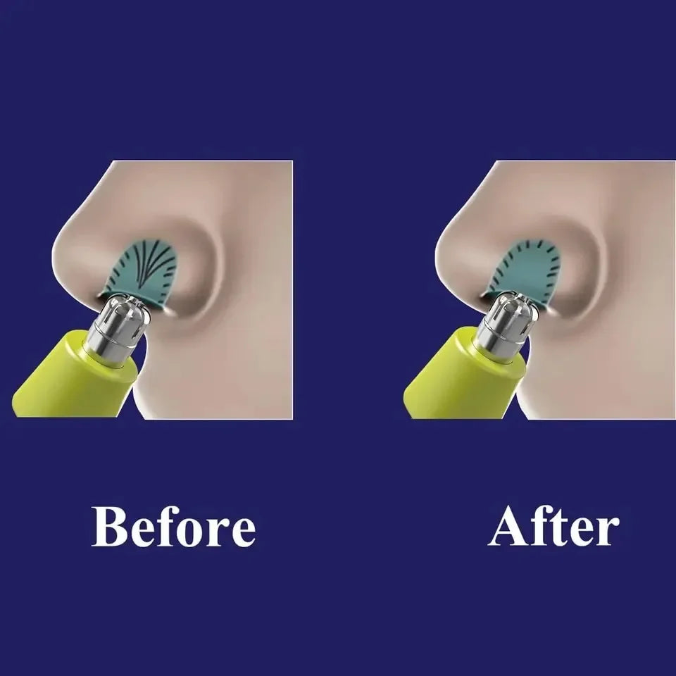Nose Hair Trimmer Stainless Steel Nose & Ear and Eyebrows Trimmers for One Blade Pro 360/QP6530/QP6510/QP6520 ﻿