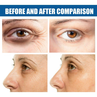 EELHOE Collagen Eye Mask Lightens Fine Lines and Dark Circles Hydrates, Moisturizes, Firms and Lifts Crystal Eye Masks