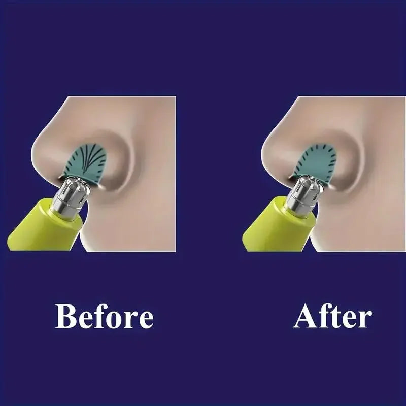 Nose Hair Trimmer Stainless Steel Nose & Ear and Eyebrows Trimmers for One Blade Pro 360/QP6530/QP6510/QP6520 ﻿