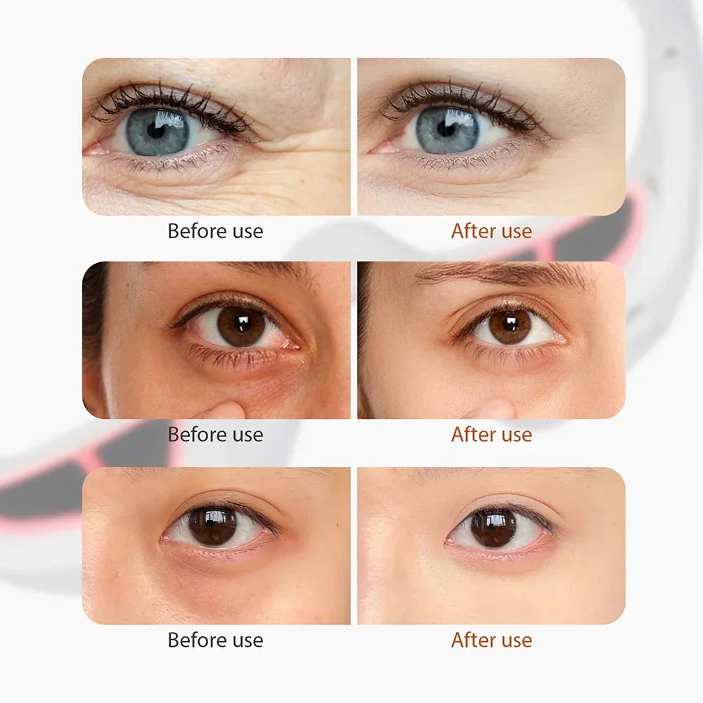 Anti-Aging Eye Massager Eyes Fatigue Relief Relaxation Relieve Dark Circles EMS Eye Care Massage